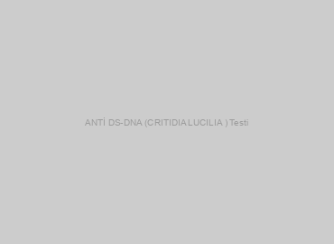ANTİ DS-DNA (CRITIDIA LUCILIA ) Testi